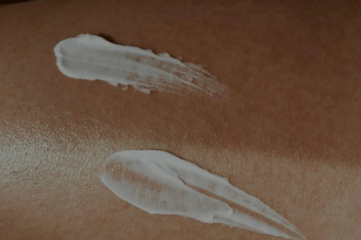 dermatitis_atopica_healing_house